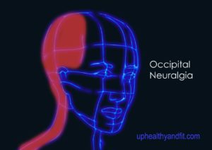 occipital-neuralgia | UpHealthyAndFit.com