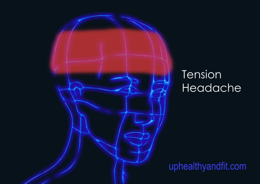 tension headache